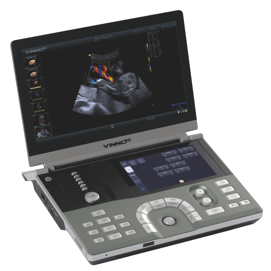VINNO 10 Ultrasound
